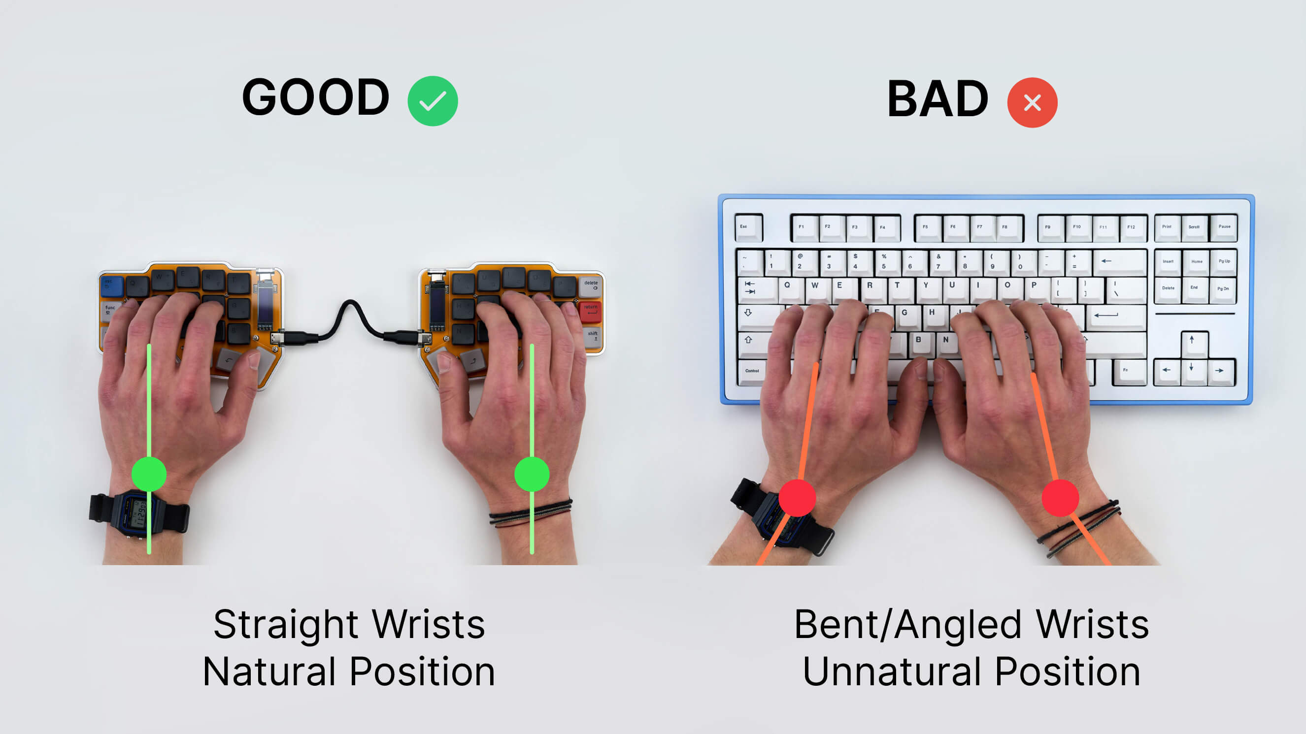 Why split keyboards are more ergonomic